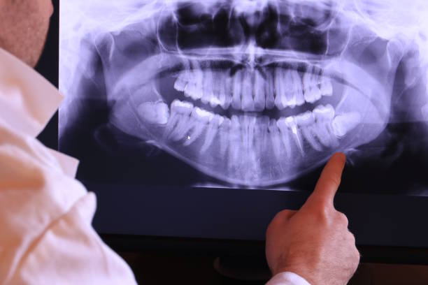 Best Emergency Denture Repair in Warren, PA