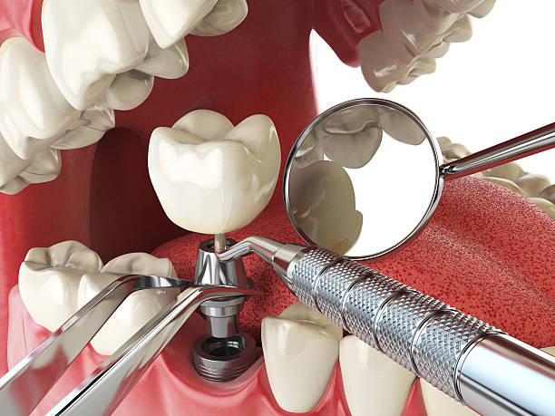 Best Emergency TMJ Treatment in Warren, PA
