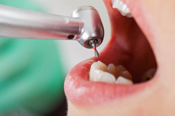Best Cosmetic Emergency Dentistry in Warren, PA